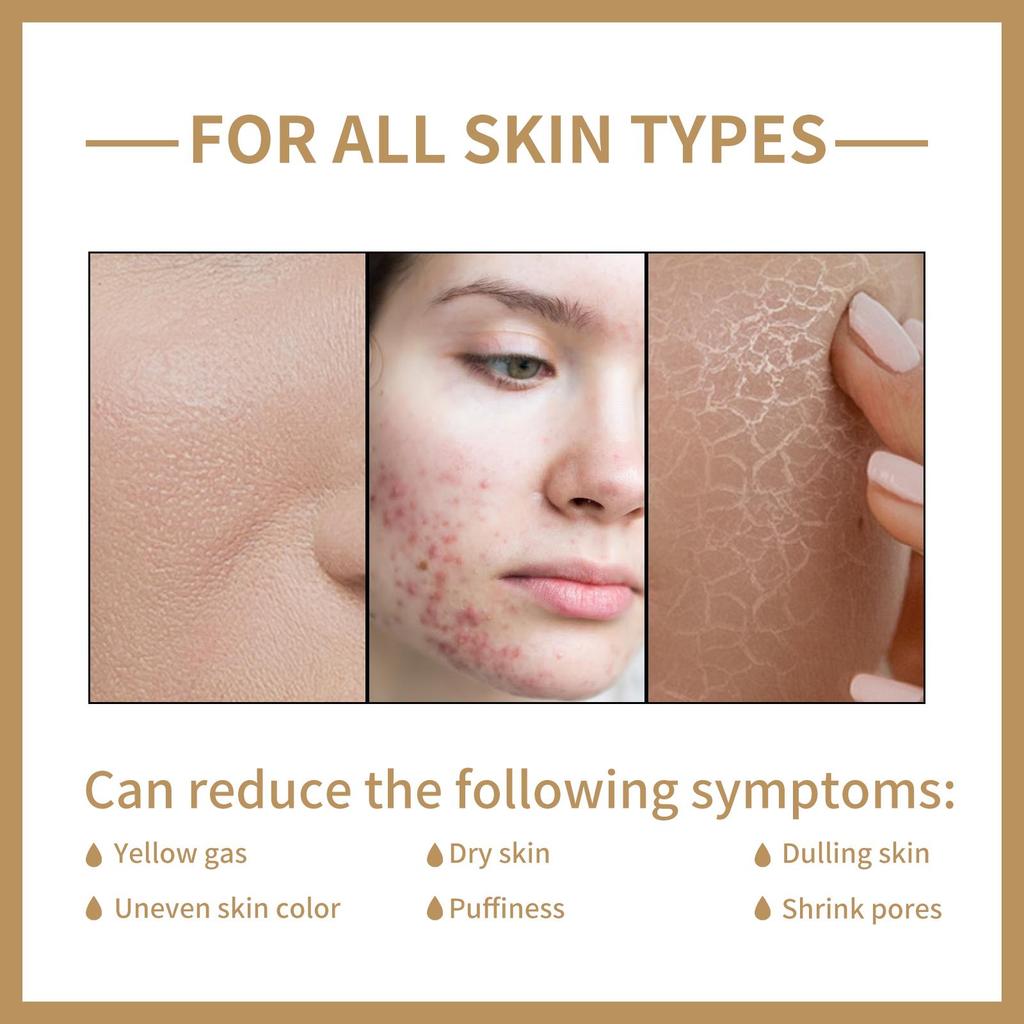 EELHOE Rice Toner 150ml: Controls Oil, Minimizes Pores, Improves Acne, Anti-aging, Moisturizes and Softens Skin.