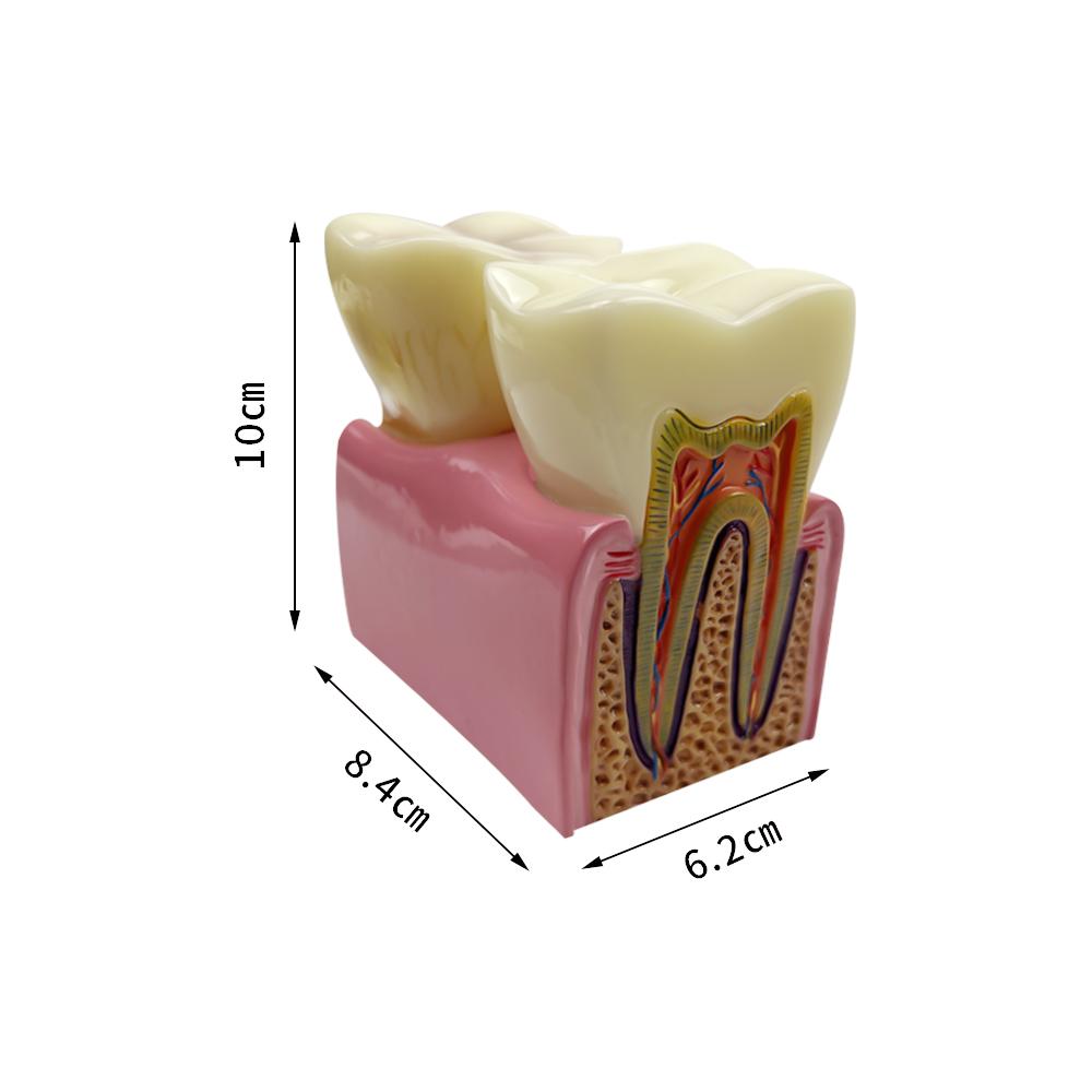 Big Dental Teeth Model Anatomy Large Dental Anatomical Model For Teaching Studying Education Demonstration Patient Communication