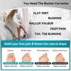 Women's Hallux Valgus Corrector: Breathable Bunion Support & Toe Separator
