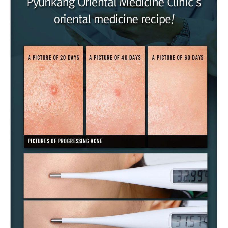 Pyunkang Yul Acne Dressing Mask Pack