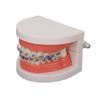Dental Typodont Teeth Model with Orthodontic Metal Bracket for Dentist Teaching Research Dental
