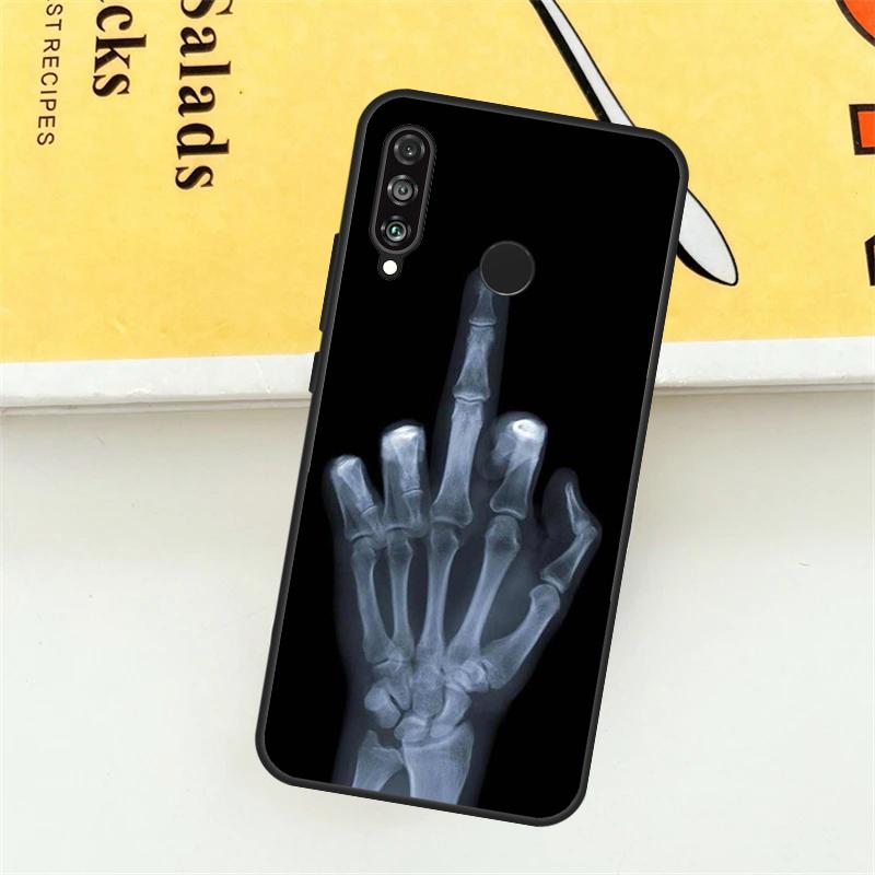 Skeleton Middle Finger For Huawei Nova 9 10 SE 7i 8i 11i 12i 12s Y73 Y72 Y61 Y91 Y90 Y70 P30 P40 Lite Y60 Pro Case