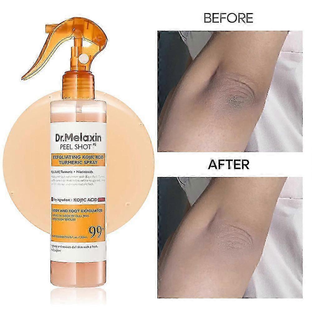 Peel Shot Keratins Care Kojic Säure Kurkuma Peeling Spray für dunkle Flecken Aufhellende Haut Tägliche Anwendung