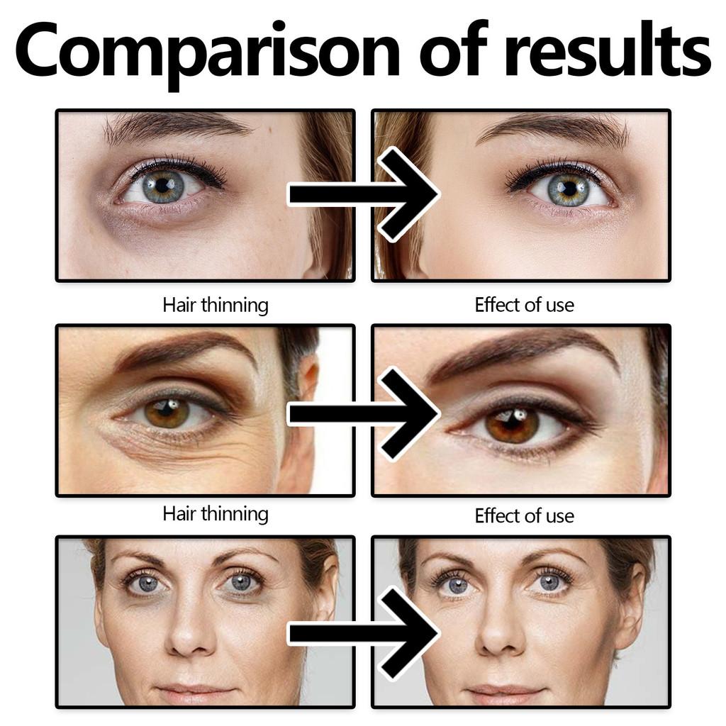 Hoygi Coffee Eye Serum 30ml For Dark Circle Reduction Wrinkle Care Hydrating Firming Treatment