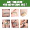 South Moon Nail Care Roller Balls - Nourishing Massage For Stronger, Faster-growing Nails With 7-day Nail Growth Formula 25-26