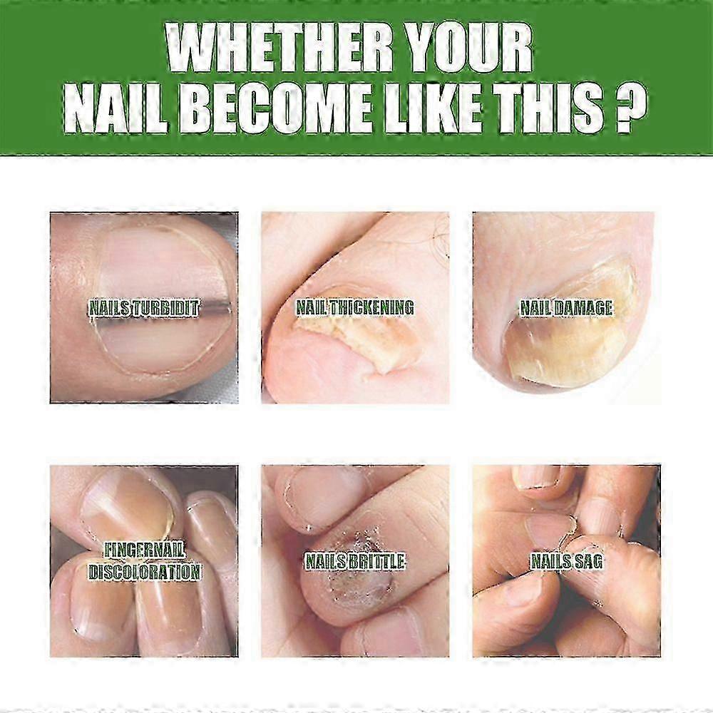 South Moon Nail Care Roller Balls - Nourishing Massage For Stronger, Faster-growing Nails With 7-day Nail Growth Formula 25-26