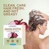 Onion Biotin Shampoo Bar Soap-Cleanse And Smooth Hair With Onion, Rosemary And Citric Acid-Moisturizes Dry, Brittle Hair, 100g