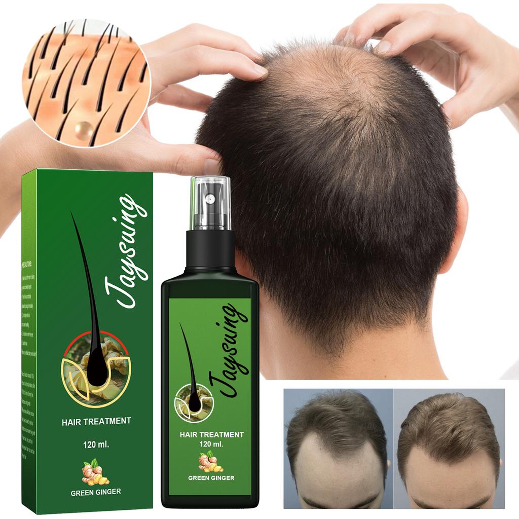 Schnelles Haarwachstum Serum Spray Gegen Haarausfall Vorbeugung von Kahlheit Kopfhautbehandlung Reparatur der Wurzeln Schönheit Gesundheit Haarpflege Für Männer Frauen