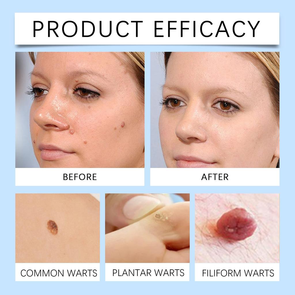 Odstranění ploché masti Cream Gram Cream Skin Care