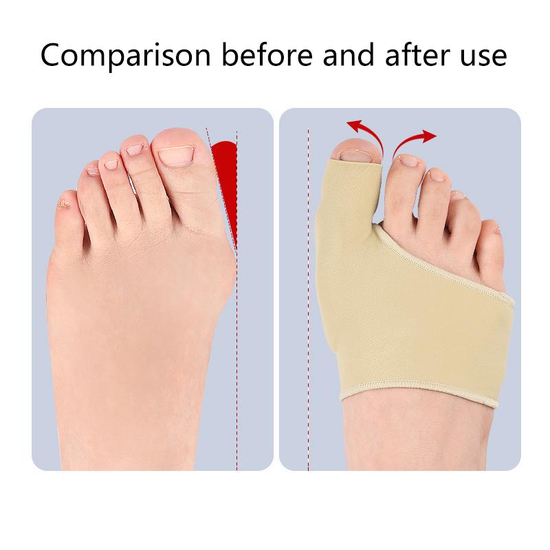 

2 Pcs/1 Pair Bunion Corrector Gel Pad Stretch Nylon Hallux Valgus Protector Guard Toe Separator Orthopedic Supplies Foot Care onesize