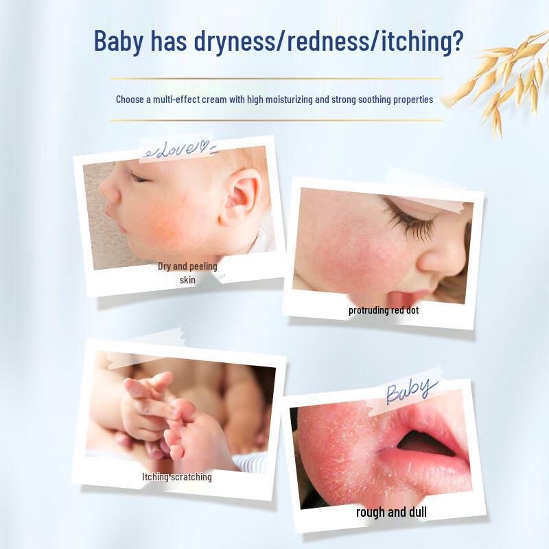 Aveeno Baby Eczema Therapy Moisturizing Cream