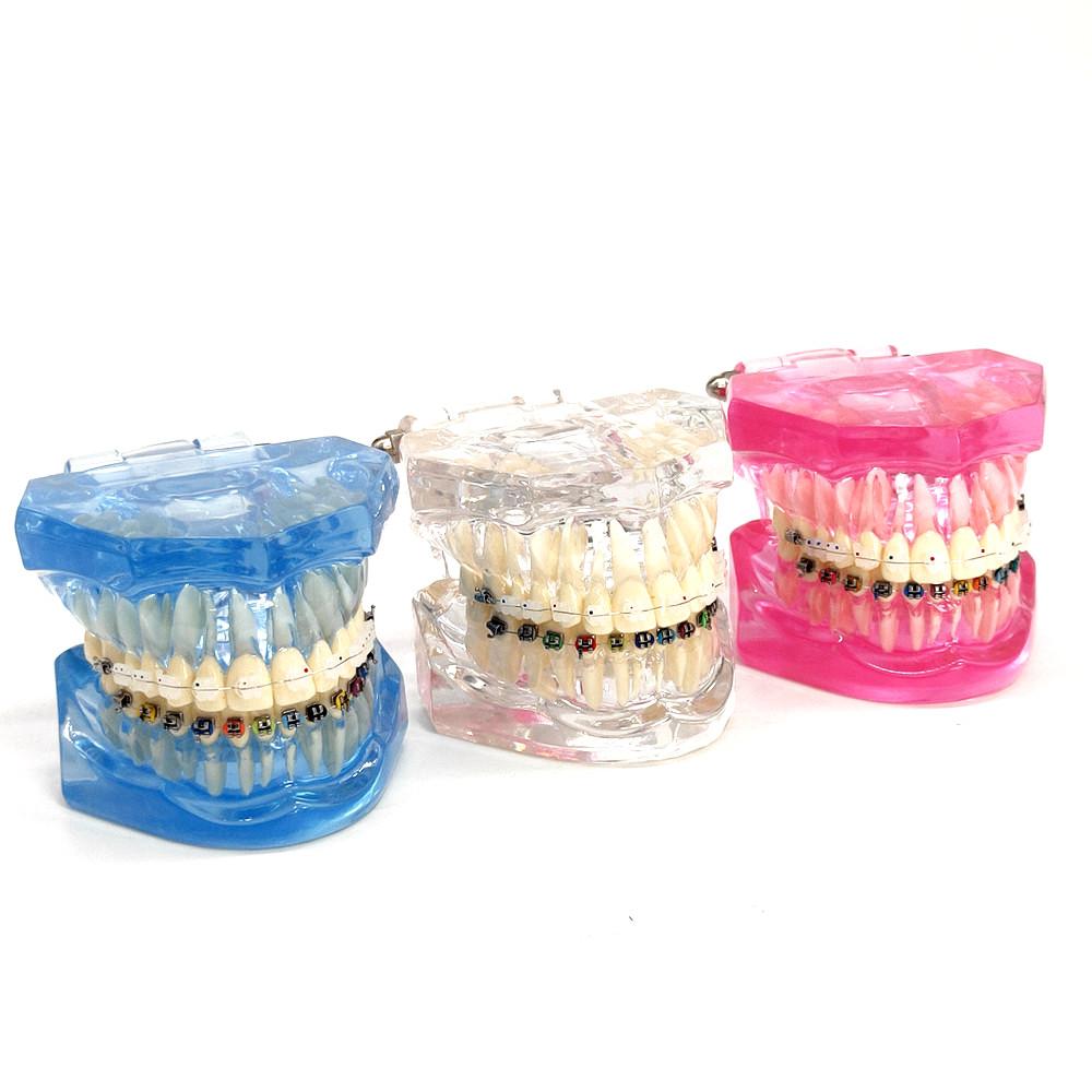 1 piece Dental Orthodontic Model Patient Communication 2 kinds Brackets with Archwires Ligatures Ceramic Bracket Metal Edgewise Bracket