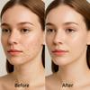 PDRN Cream – Repairing & Nourishing, Moisturizing & Antioxidant