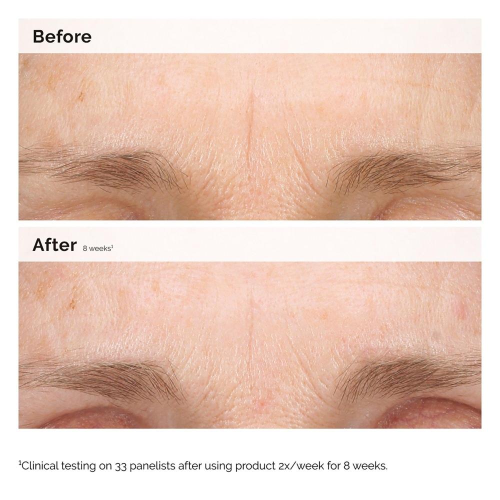 The Ordinary Retinal 0.2  Emulsion 0.5 Oz