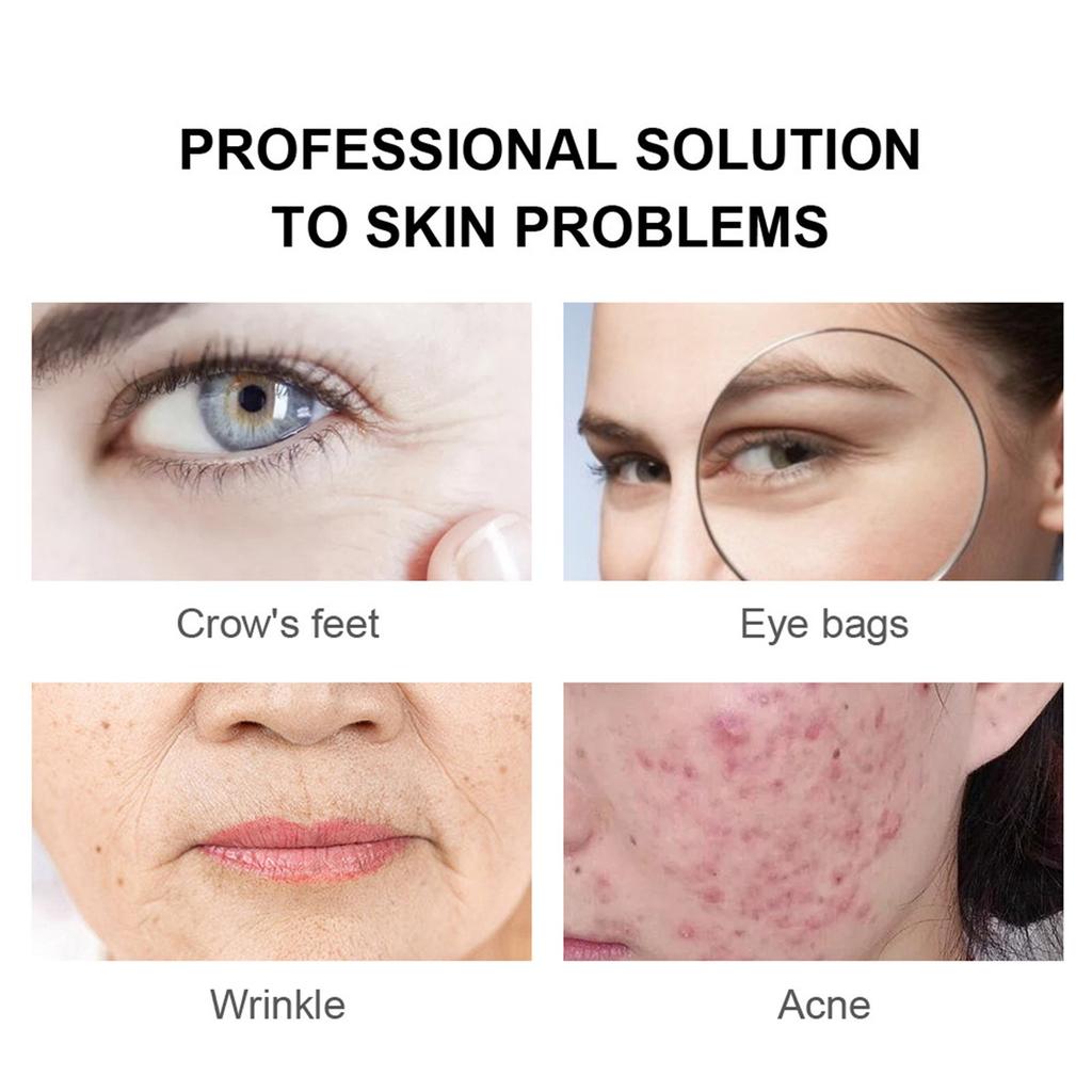 Eye Cream 30ml Brightens And Reduces Fine Lines And Crow's Feet Anti-oxidant Firms And Brightens