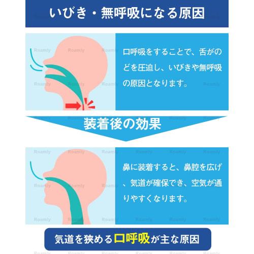 Roamly Anti-Snoring Nose Clips, Set of 6, Nasal Cavity Expanders, Anti-Snoring Device, Snoring Improvement Device, Magnetic, Washable, Promotes Nasal