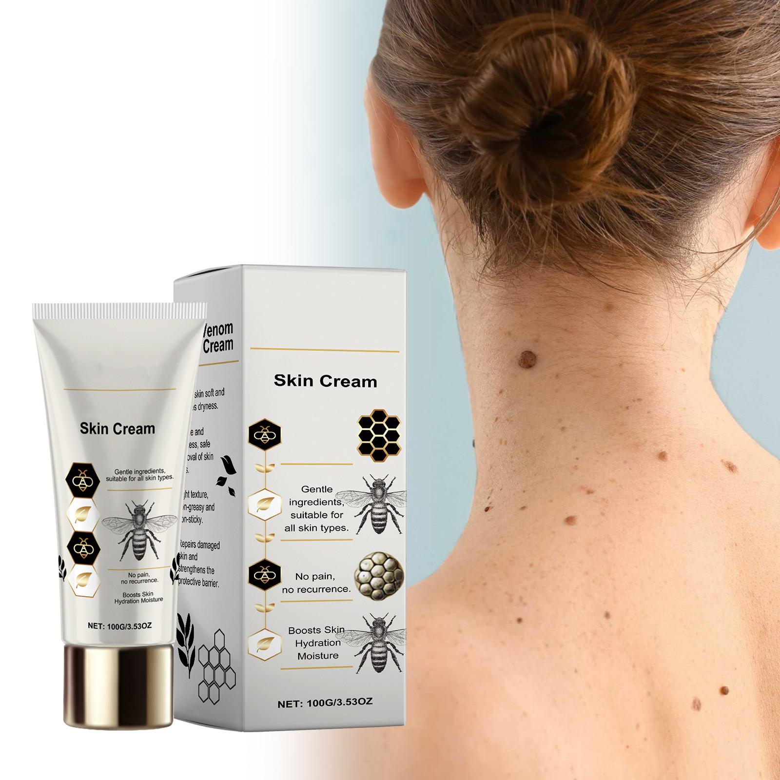 

Крем для кожи от папиллом Облегчение папиллом и зуда кожи и дискомфорта Увеличивает влажность кожи