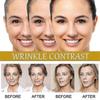 3x Advanced Bee-venom Serum Anti-aging Moisturizer For Face And Neck--