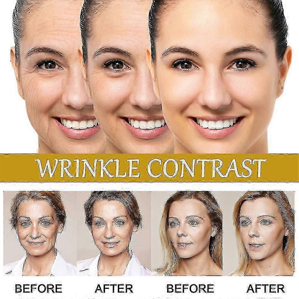 3x Advanced Bee-venom Serum Anti-aging Moisturizer For Face And Neck--