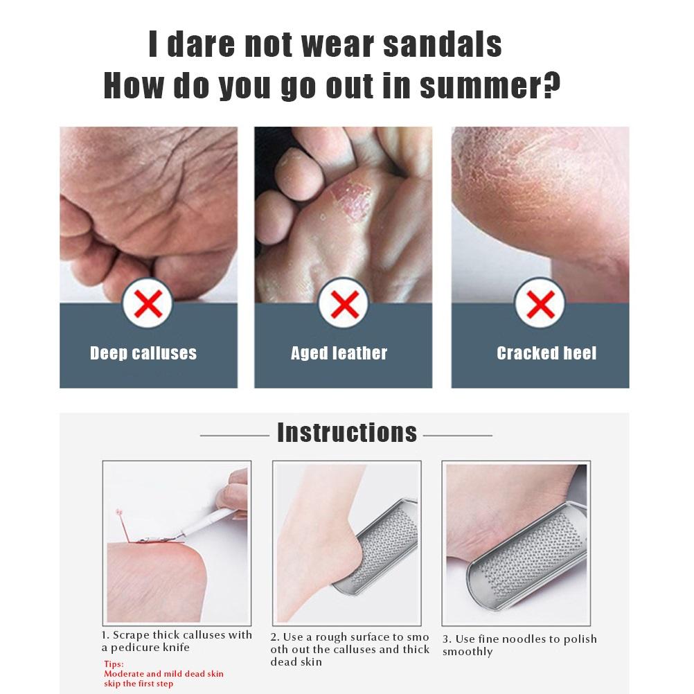 Professional Feet Rasp Scrubber Foot File Feet Callus Remover for Rough Dead Skin Removal