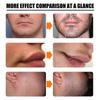 2pcs Natural Men Beard Growth Roller Kit Men's Beard Growth Oil Nourishing Enhancer ,Moustache Growth Enhancer 30ML