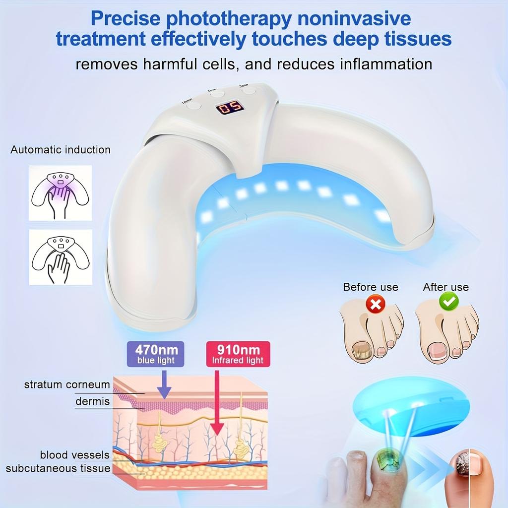 Laser neglesterilisator, 2 ganger rask muggfjerning og reparasjon, spesielt for negler med flere tær, sammenleggbart muggrengjøringsutstyr