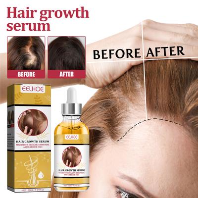Olio essenziale per la crescita dei capelli allo zenzero Prodotti naturali anticaduta Crescita rapida Prevenire il trattamento della calvizie Liquido germinale Uomini Donne