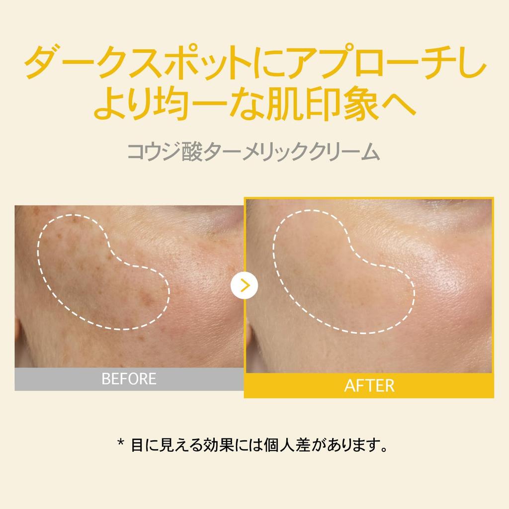 TOSOWOONG Kojic Acid Turmeric Cream 50ml 7,000ppm Kojic Acid, Turmeric, Niacinamide, Collagen, Tone Care, Dark Spots, Dullness, Tosowoon Korean