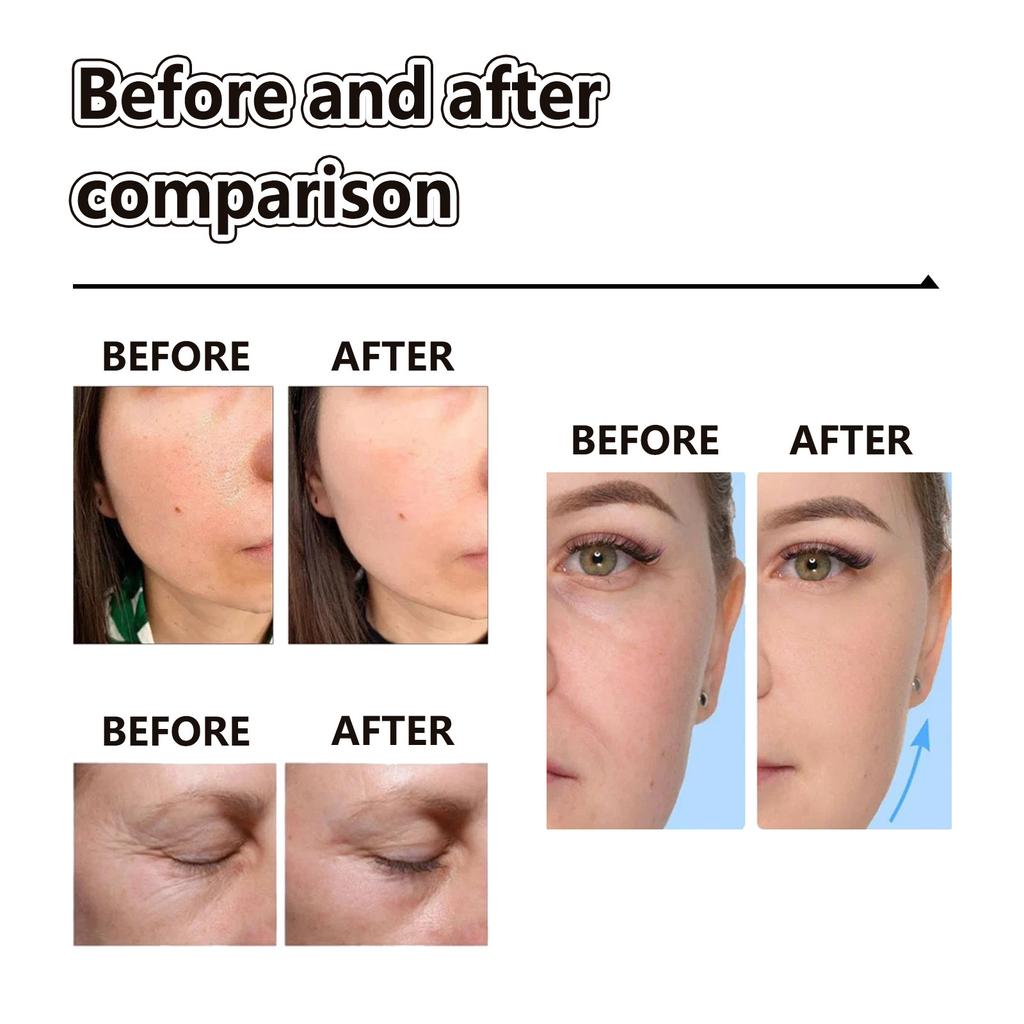 Eelhoe Face Cream Retinol Face Cream Remove Dark Spots Whitening Face Care Moisturizing Anti-Aging Firming Skin Care Cosmetics 100ml