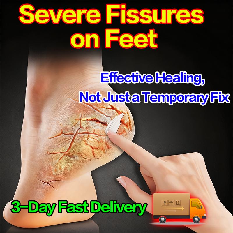 Intensive Repair Foot Cream for Severely Dry & Cracked Skin