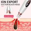 USB Rechargeable Blackhead Remover Electric Tool Blackhead Vacuum Cleaner  Acne Treatment