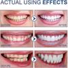Sp-6 Probiotic Toothpaste, Sp-6 Ultra Toothpaste For Teeth Whitening, And Gum Health, Fluoride-free Mint Flavor 2PCS 25-26