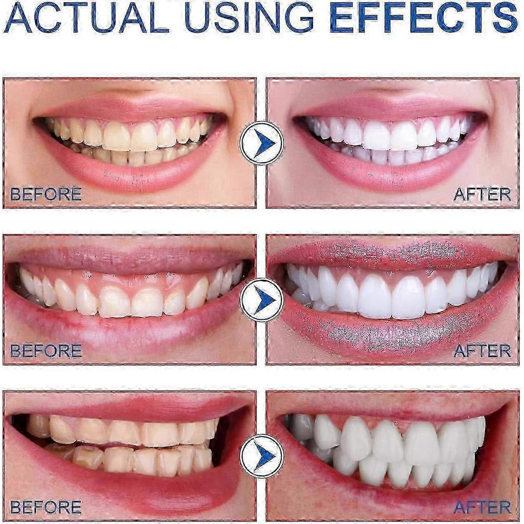 Sp-6 Probiotic Toothpaste, Sp-6 Ultra Toothpaste For Teeth Whitening, And Gum Health, Fluoride-free Mint Flavor 2PCS 25-26