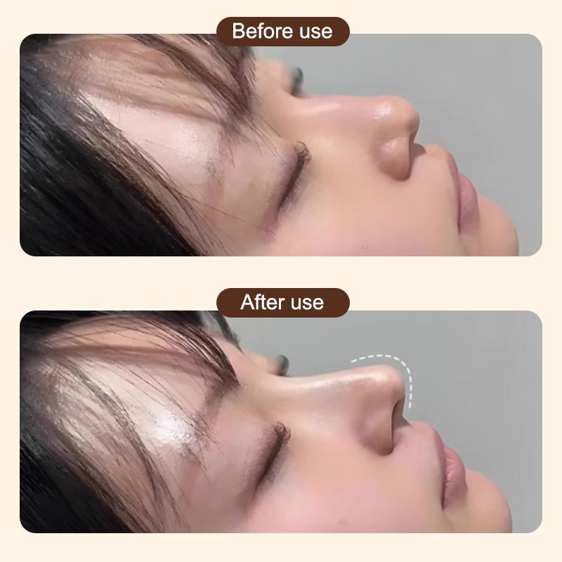 3/ 5Pcs Low Temperature Thermoplastic Nasal Splint Plastic Surgery Plastic Plate Orthopedic Orthopedic Fixator