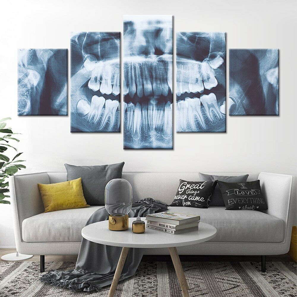 5Pcs Teeth Tooth Xray Dentist Decor 5 Pieces Pictures Wall Poster Home Decor 5 Panel Room Decor Modern Abstract Art No Framed