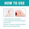Wound Relief Gel, Liquid Wound Suture Glue, Isolate And Keep Dry 10ml