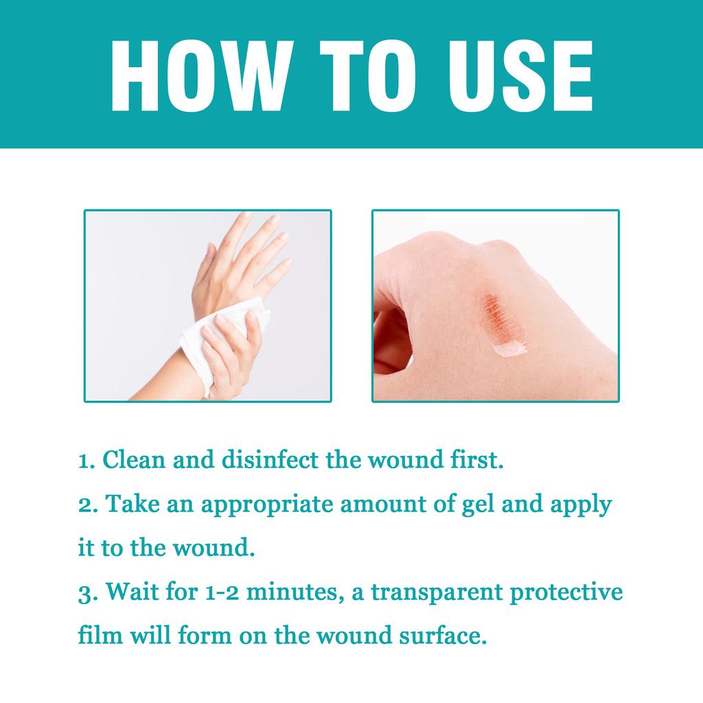 Wound Relief Gel, Liquid Wound Suture Glue, Isolate And Keep Dry 10ml