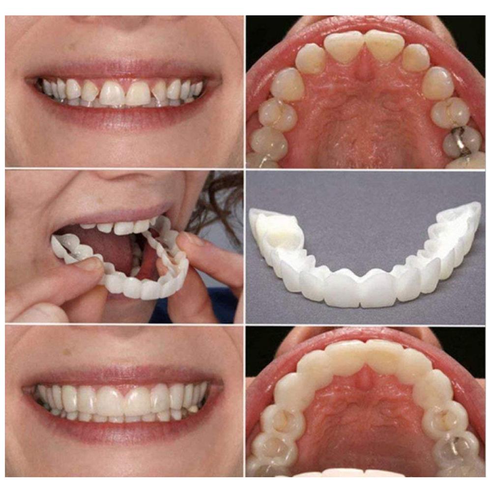 2 Pairs Comfort Upper and Lower Jaw Denture Denture Care Upper False Tooth Cover Snap Regain Confident Smile Perfect False Teeth