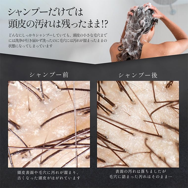 Scalp Scalp Cleanser for Home Pore Head Pore 3 Scalp Rechargeable [Water Peeler] Use, Cleanser, Cleanser, Care, Modes, Care,