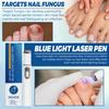 Dispositivo Portátil de Tratamiento para Hongos en Uñas de Pies y Manos, Herramienta de Cuidado para Reparación de Uñas para Paroniquia, Uñas Dañadas y Descoloridas