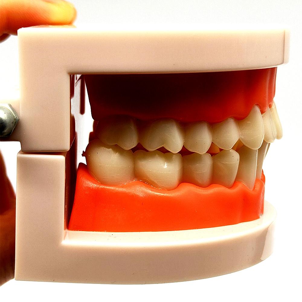 1 Piece Dental Tooth Model Standard Teeth Model Dental Caries Model for Patient Communication Dentist Study Model with Decayed Tooth