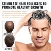 5 st Spartan Root Activator Schampo, Spartan Håravfallsschampo,schampo Root Activator