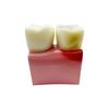 Big Dental Teeth Model Anatomy Large Dental Anatomical Model For Teaching Studying Education Demonstration Patient Communication