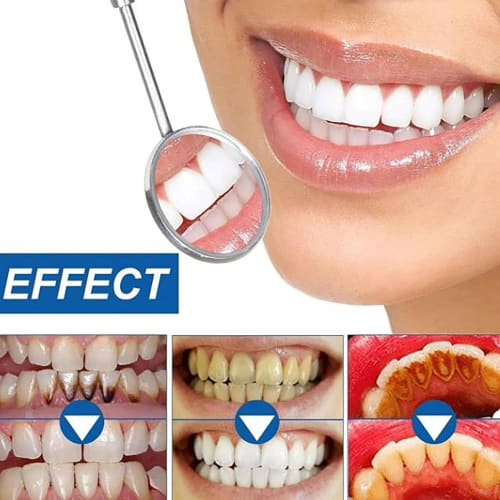 Niacinamide Whitening Toothpaste, Bright White Toothpaste, Niacinamide Toothpaste, Niacinamide Whitening Toothpaste, Fluoride-Free, Gentle Mint, Fresh