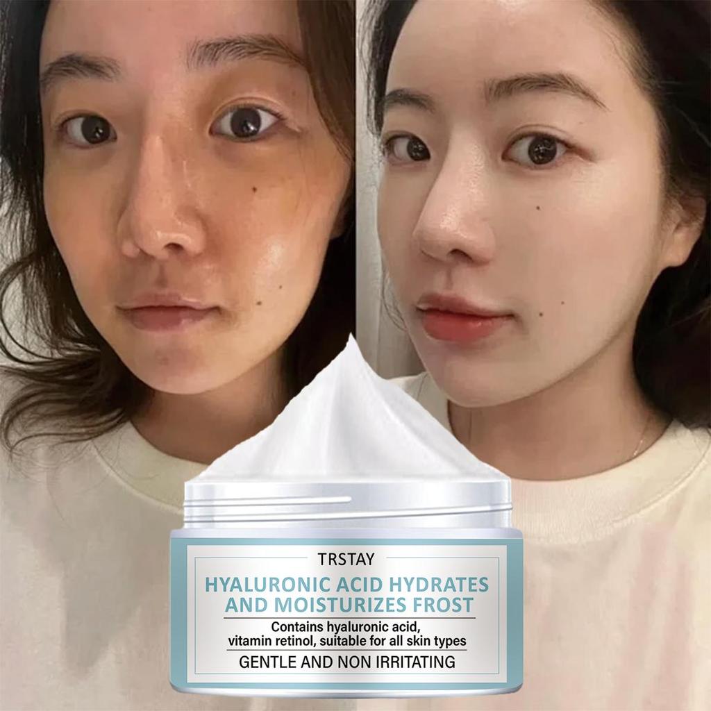 Retinol Moisturizing Face Cream, Mild and Non Irritating, Moisturizes, Brightens Skin Tone, and Makes Skin Soft and Delicate