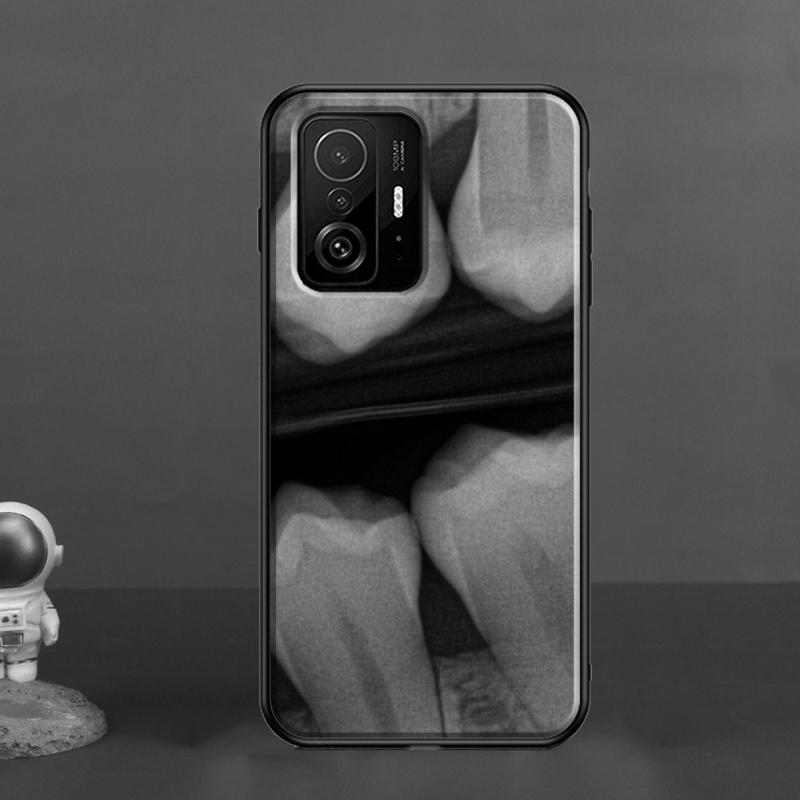 Dentist Tooth Pattern For POCO X5 X3 F5 Pro X4 F4 GT M5s C40 F3 Case For Xiaomi 13 Lite 12 11T 12T Pro 12X Cover