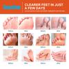 Sumifun 30/60/150ML Relieve Foot Odor Spray Foot Sweating Toe Anti-Itching Summer Essential Exercise Foot Care Bacteriostat Liquid Spray