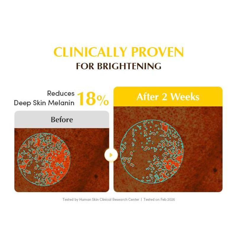 Eqqualberry Collagen Glow Up Hydrogel Mask Set