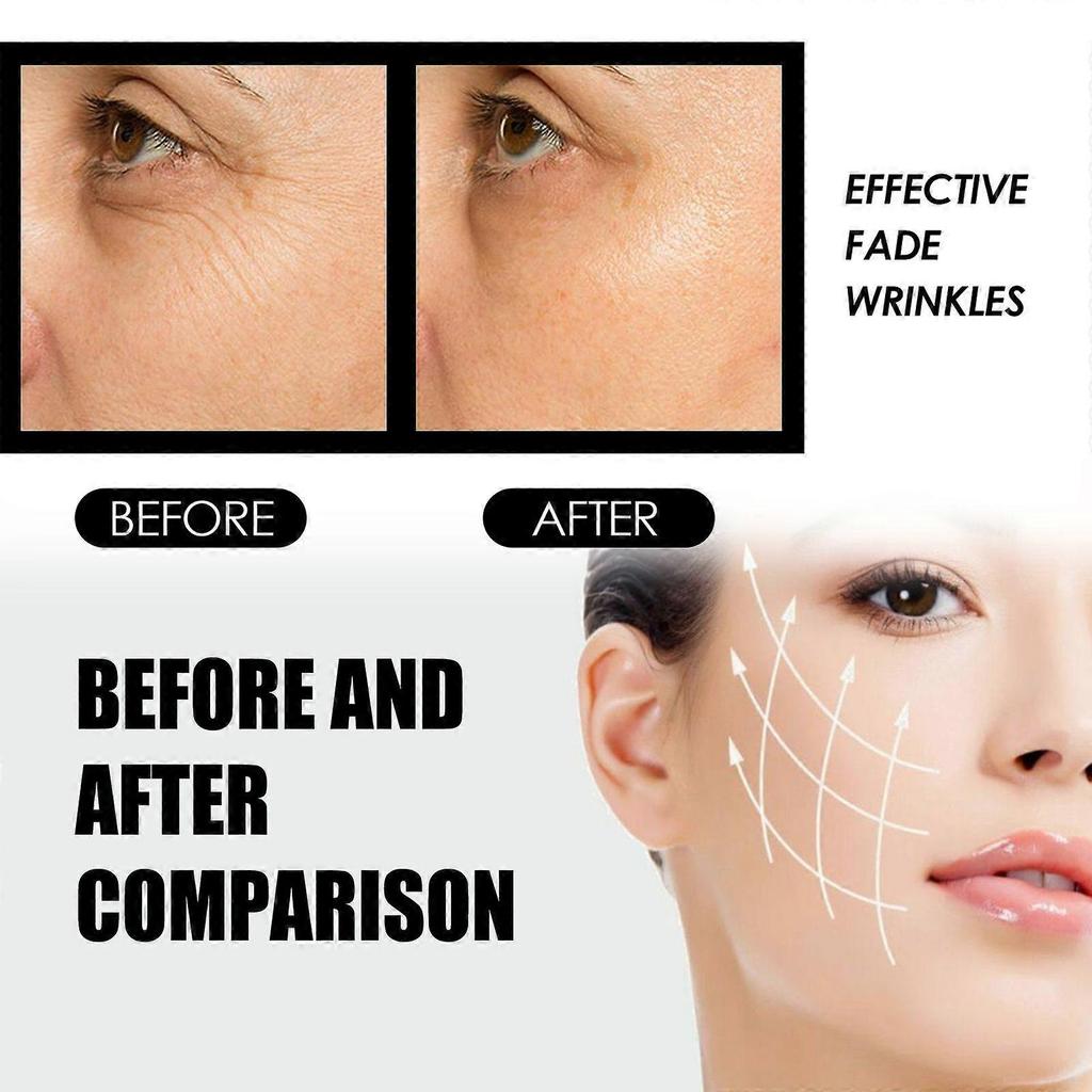 West Month Anti-Wrinkle Firming Eye Cream Hydrating, Moisturizing, Nourishing, And Repairing Dark Circles Around The Eyes