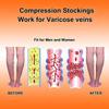 Medical Calf Compression Sleeve 30-40Mmhg Footless Varicose Veins Support for Men Women